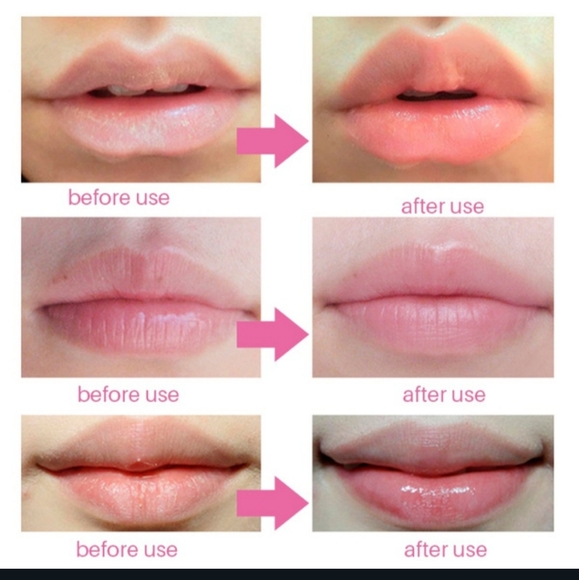 Hydrating, Collagen Lip plumping Lip Mask - Picture 3 of 7